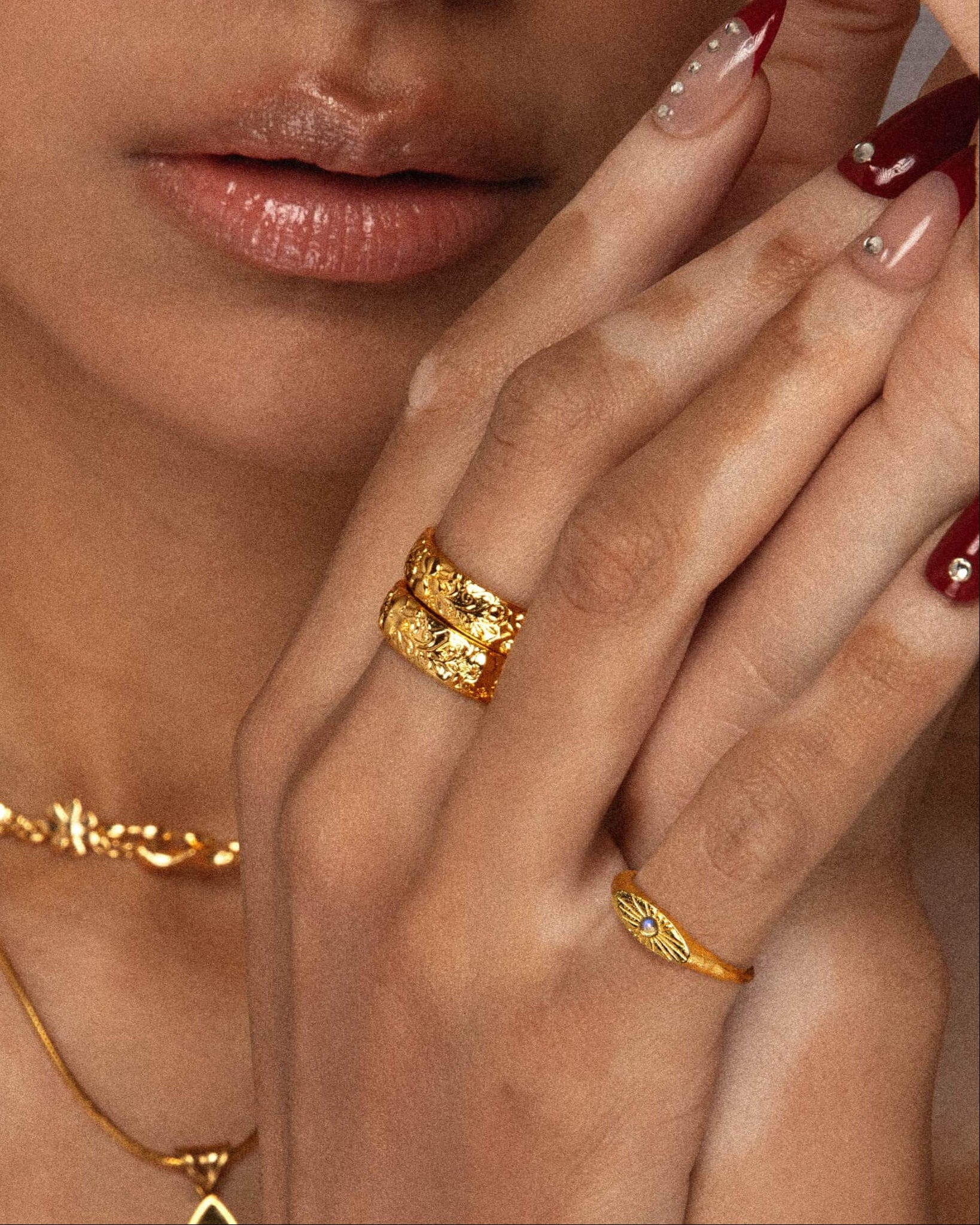 Serenade of Orchid Ring - Image 2