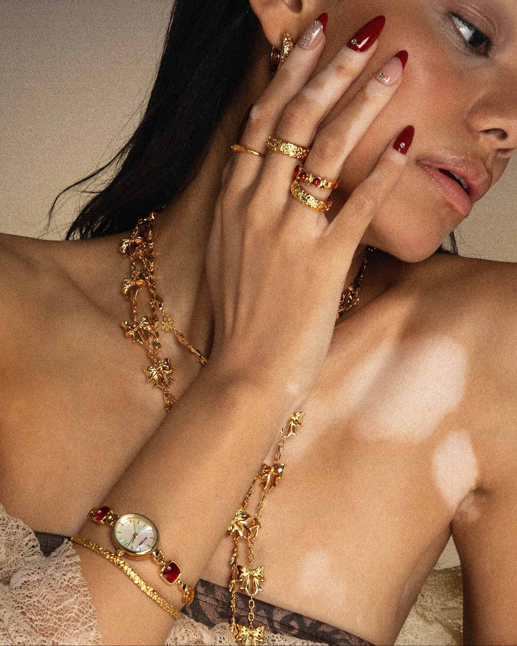 Serenade of Orchid Ring - Image 4