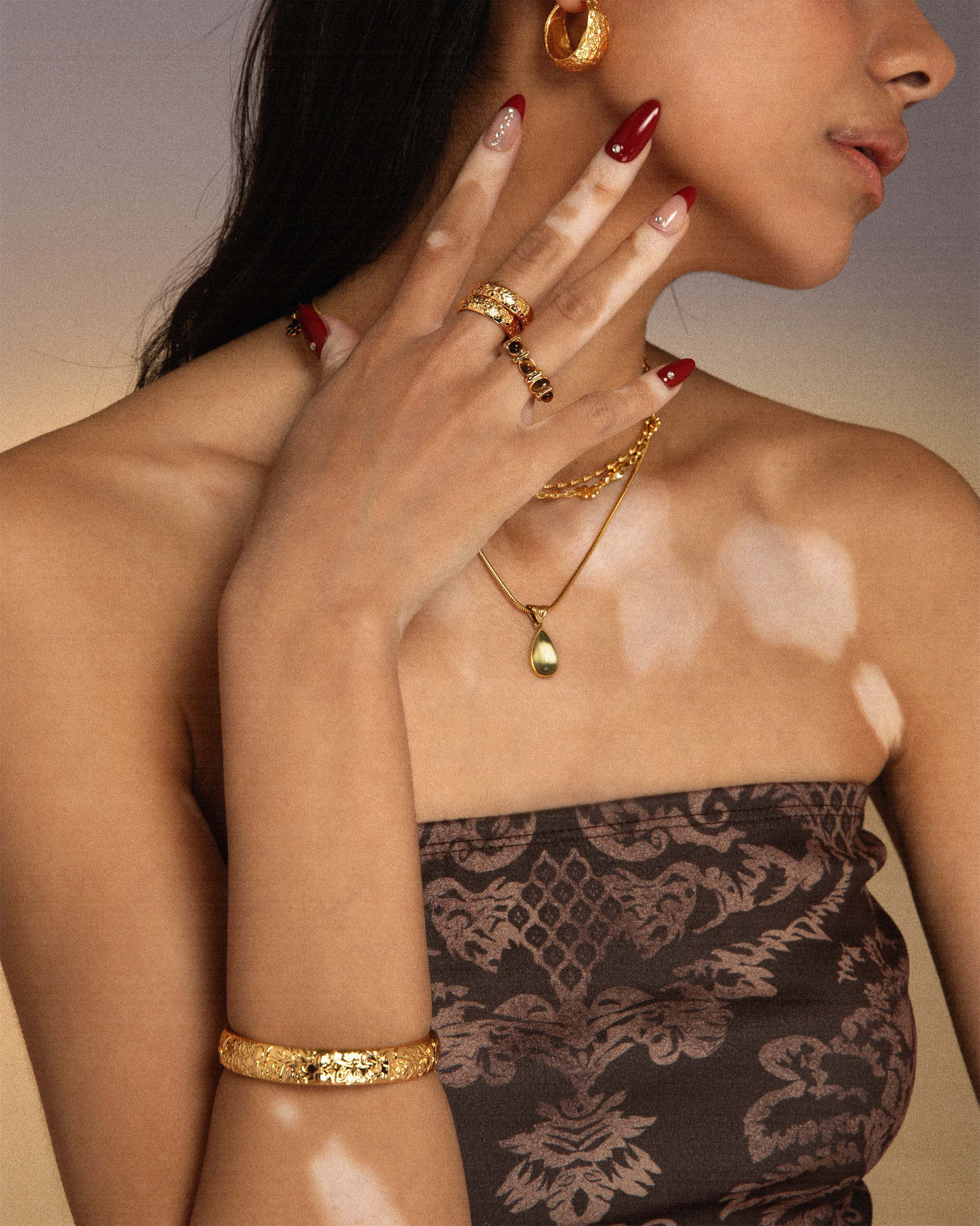 Serenade of Orchid Set - Image 3
